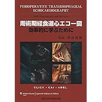 解きながらレベルアップ経食道心エコ-問題集 | ト-マス・M.バ-チ